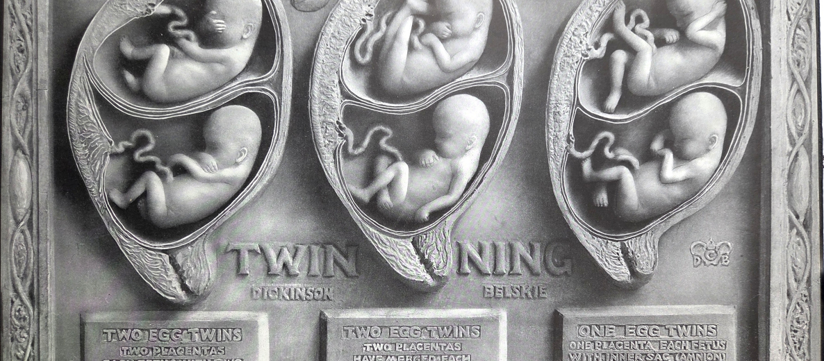 Birth atlas
