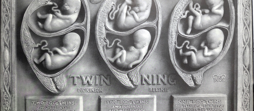 Birth atlas