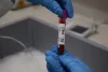 Próbka w Centralnym Biobanku
